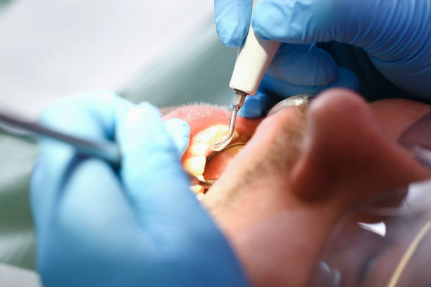 Best Tooth Infection Emergency Dentist  in Roseland, OH