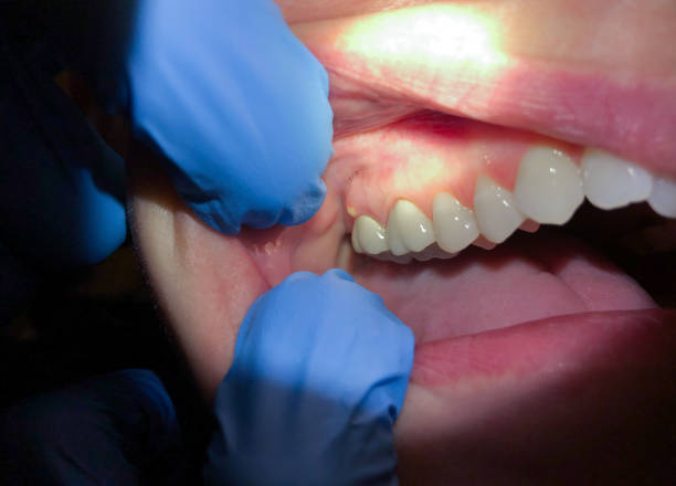 Emergency Dentist Open Today in OH